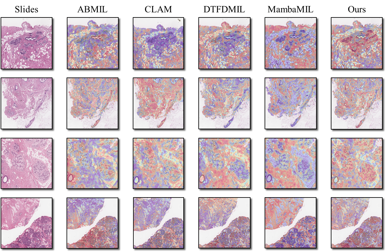 Compared to baselines, ReconMIL exhibits significantly sharper tumor boundaries and superior suppression of background noise.
