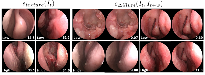 Example images showing endoscopic challenge cases for low versus high texture and change in illumination