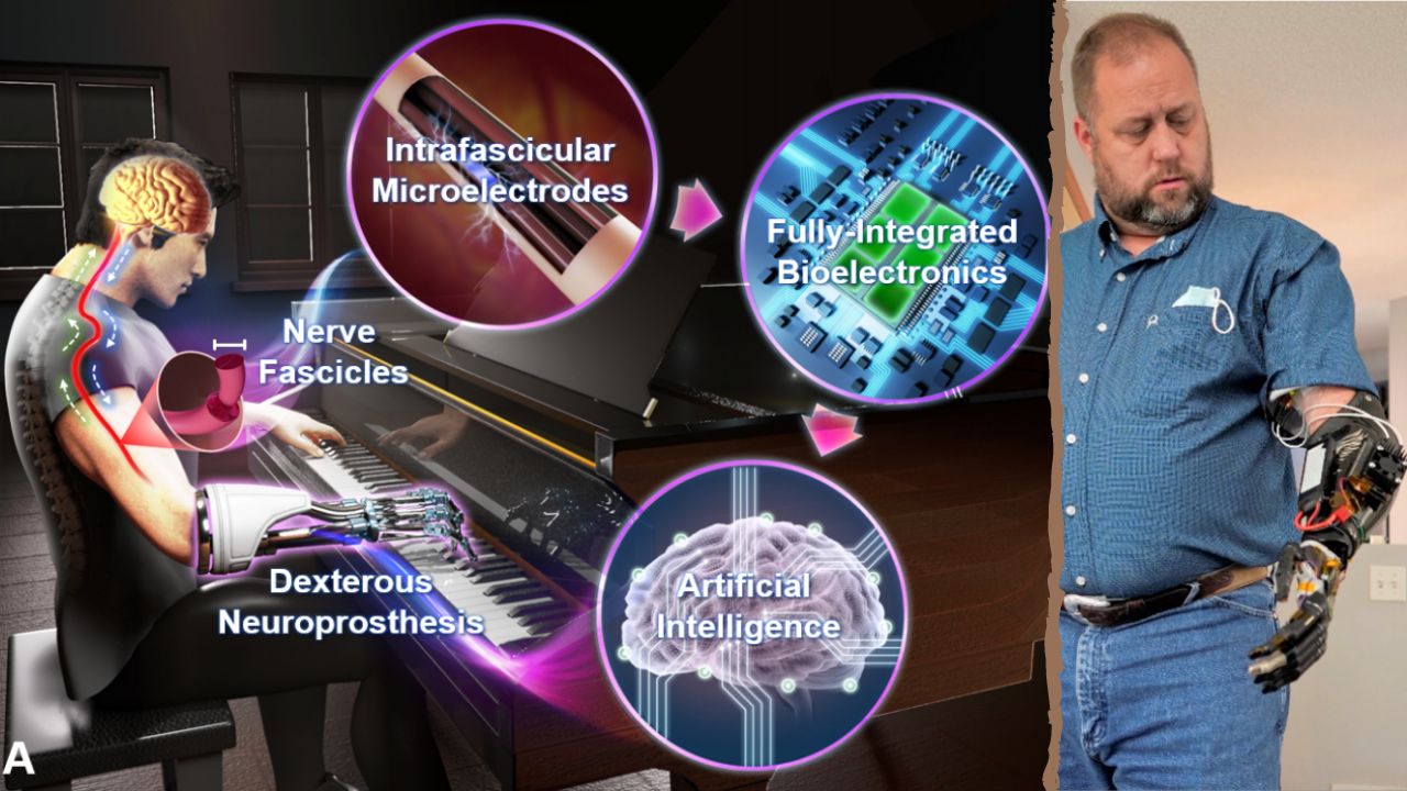 From Amputee to Cyborg with this AI-Powered Hand 🦾