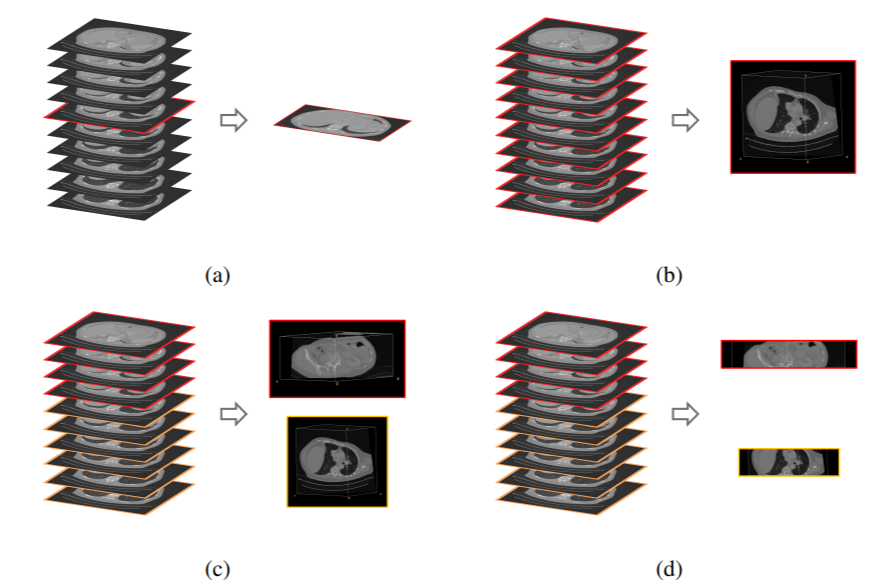 Why One Small Parameter Can Make or Break Your Medical Image Retrieval