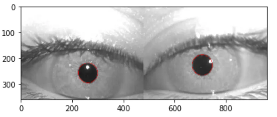 Insights Through Vision: Tracking Eyes Using OpenCV for Blink Detection