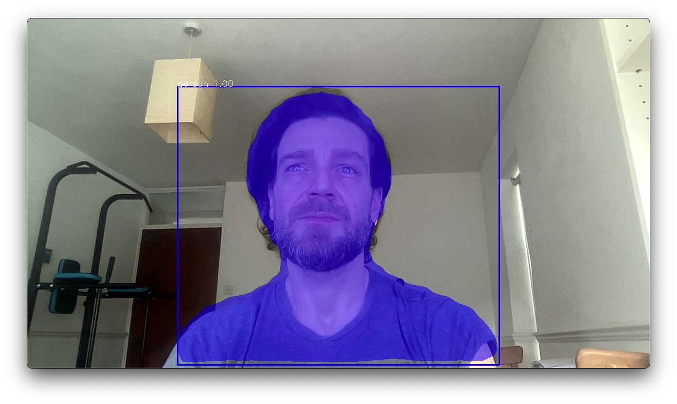I am detected successfully. Thank you, PixelLib for not detecting my dark circles