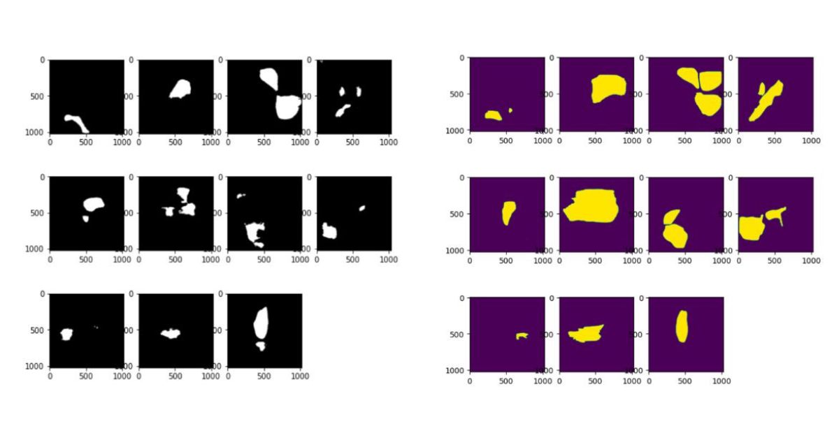 U-net prediction vs. best detectron2 prediction