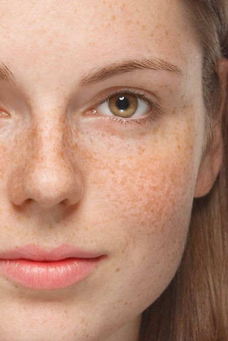 featured image - Dubai's Experts in Pigmentation Treatment: Dermatologists You Can Trust