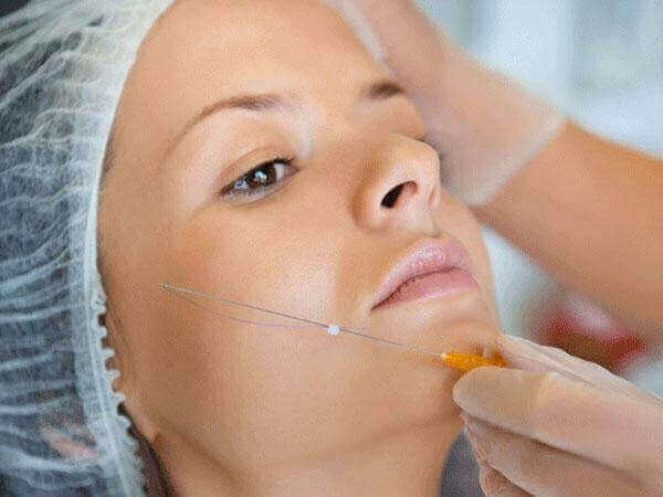 featured image - Thread Lifts: The Ultimate Rejuvenation in Dubai