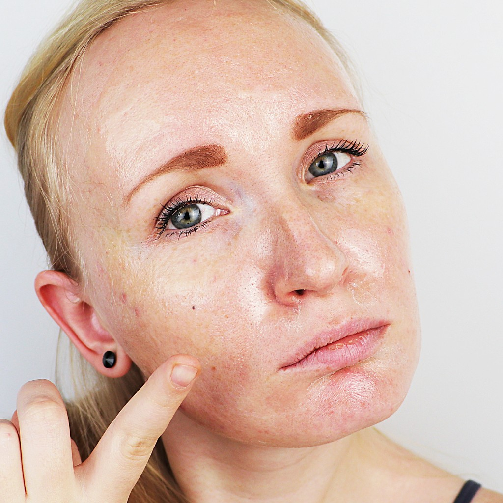 featured image - Enhance Your Skin's Texture with the Cosmelan Peel in Dubai! 