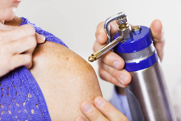 featured image - Icing on the Treatment: Cryosurgery's Rise in Dubai