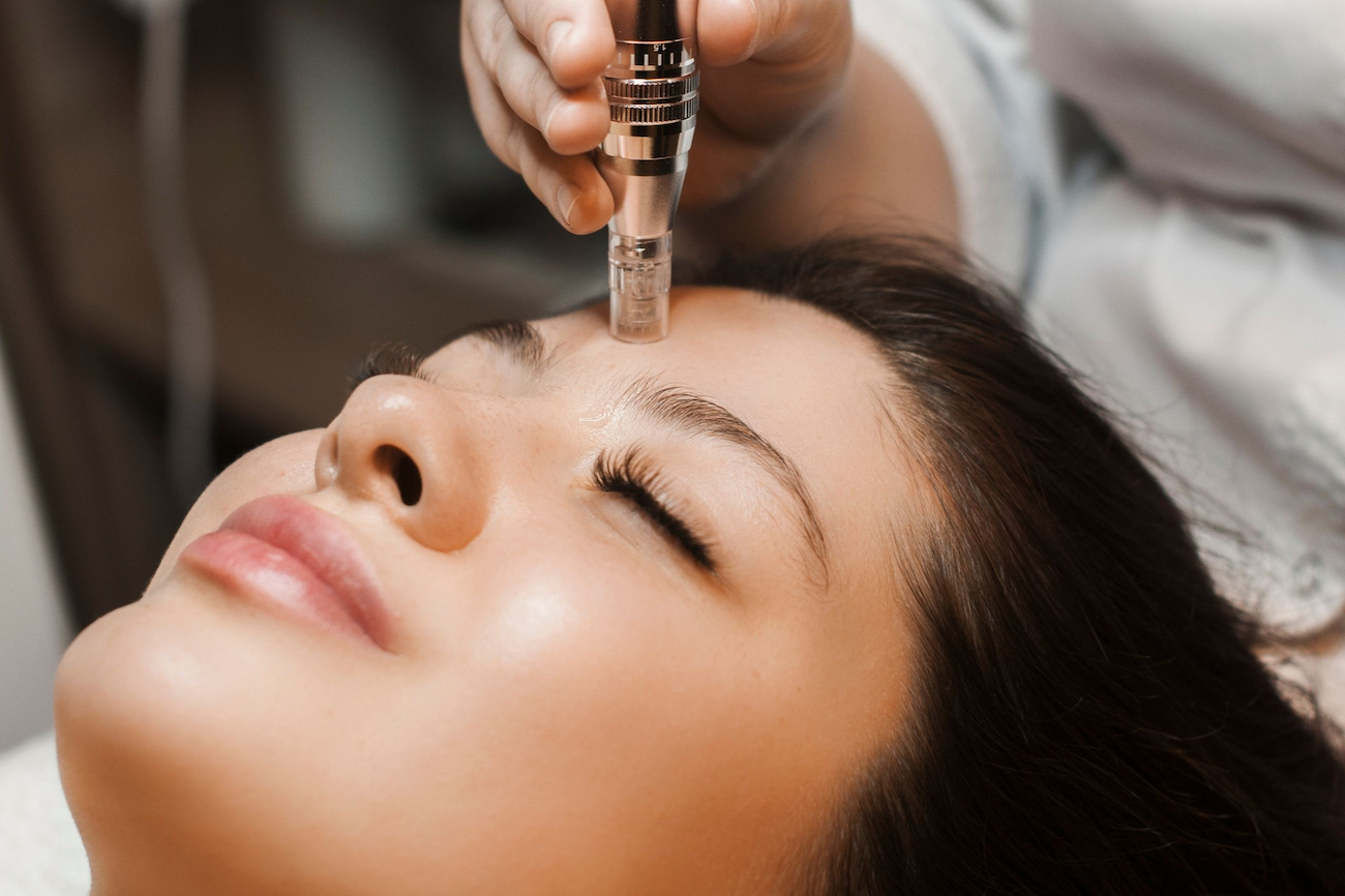 featured image - Elevate Your Beauty with Microneedling in Dubai