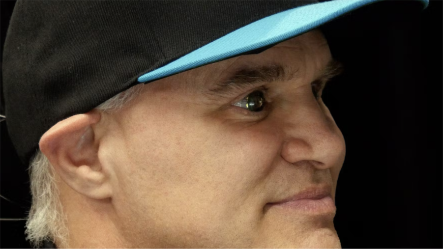 Drew Perkins didn’t just believe in his vision — he literally put his eye on the line for it. Source: Mojo Vision