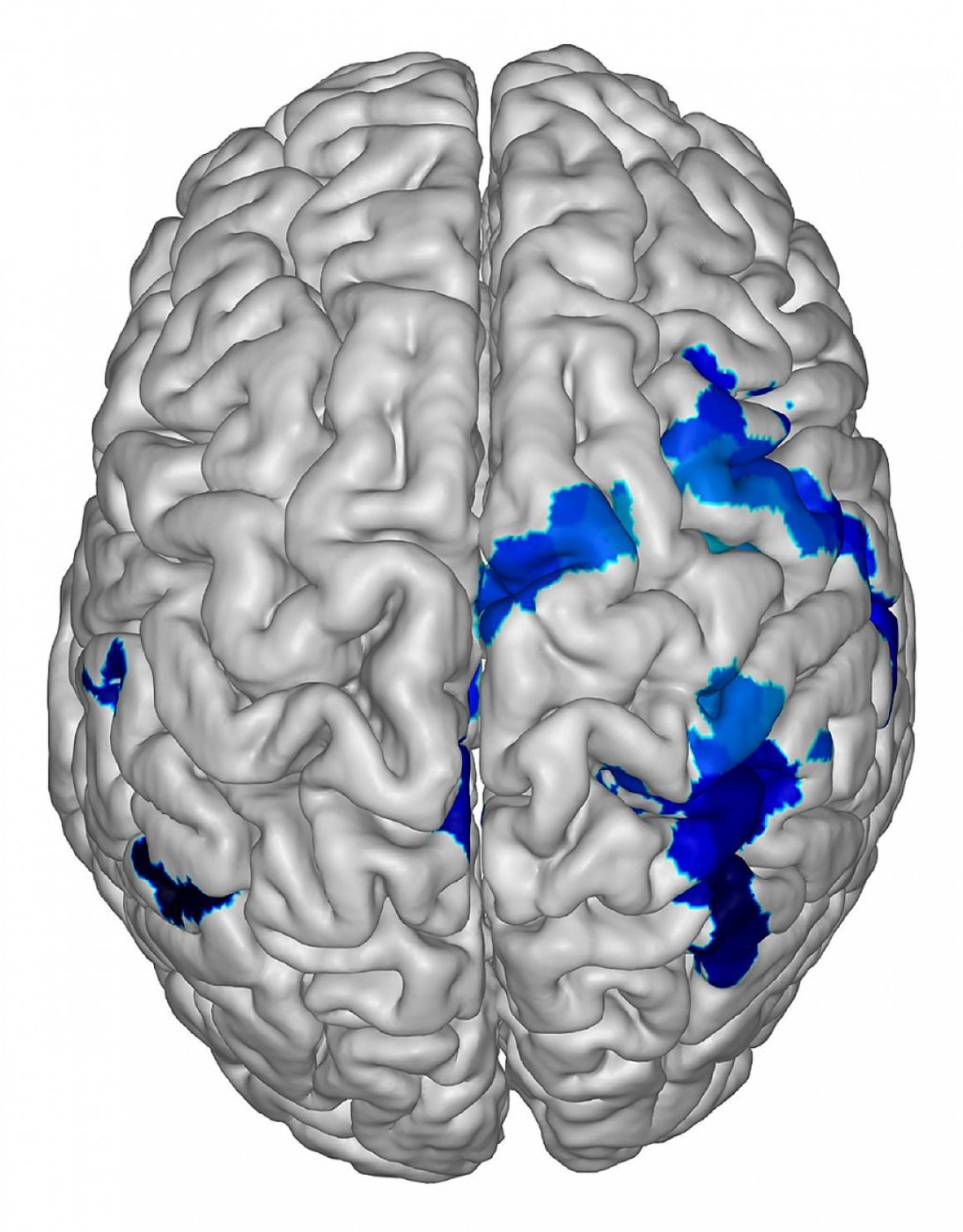 LLMs | Sentience: What Does Consciousness Do and How?