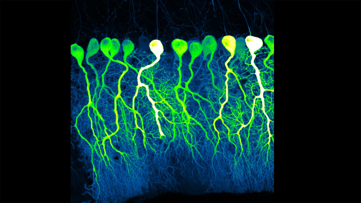 AI Sentience: How Neural Correlates Setback Consciousness Research