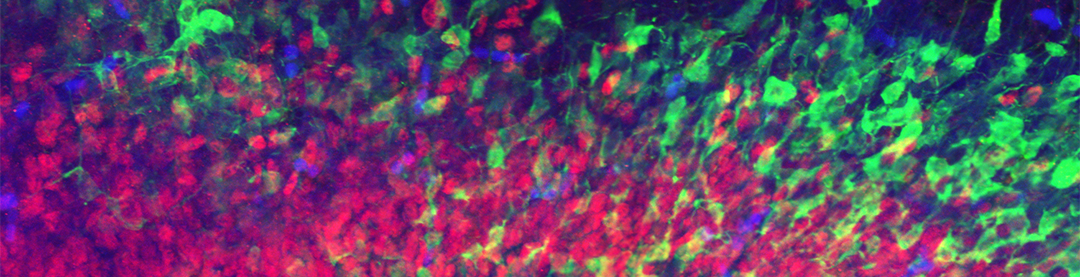 Mapping the Mind: Can Mice Brains Help Harvard Researchers Chart the Human Connectome? 