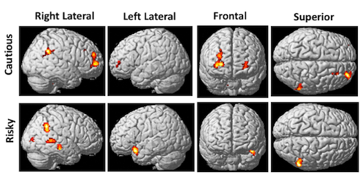 AI: Sleep Computational Neuroscience, Dreams, Loneliness, and Predictive Coding