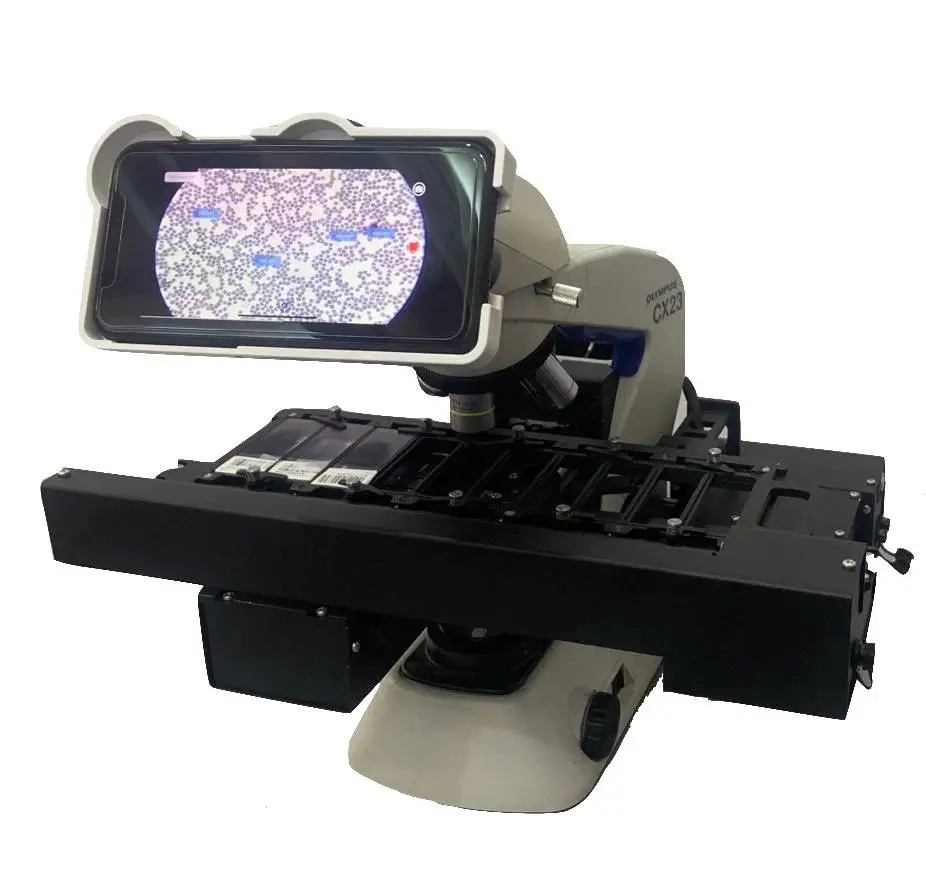 Microscope with iPhone and motorized stage below