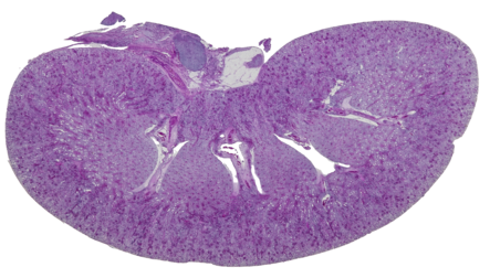 Histological tissue image at 4x magnification