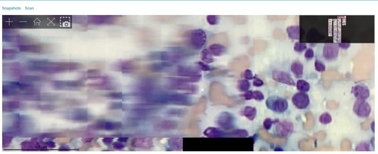 Blurred frames overlaid on the scan during abrupt movement