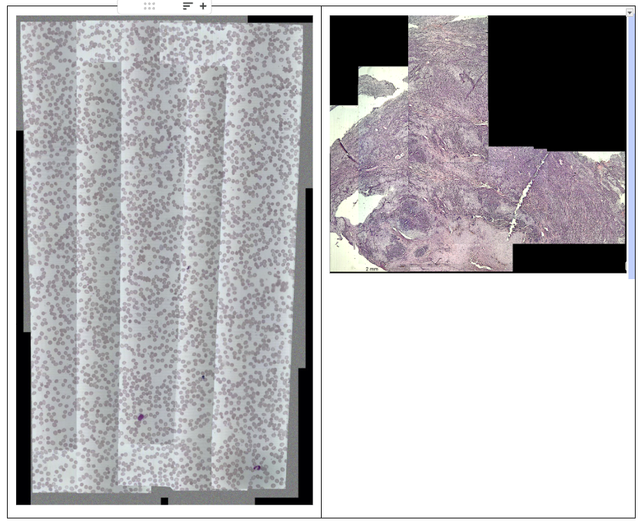 On the left — a map with uneven brightness and exposure, where “seams” are visible at the frame junctions. On the right — unevenly stitched tissue images with gaps.