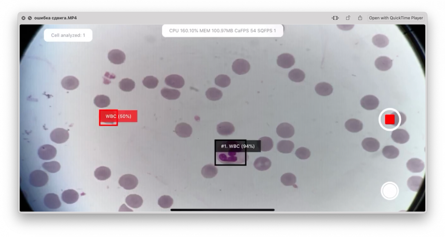 A red highlight marks an erythrocyte discarded by the filters.