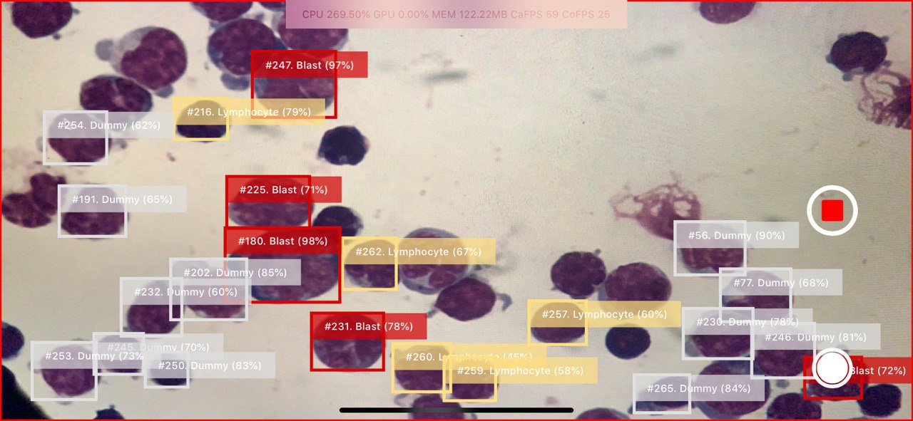BBoxes of detected cells