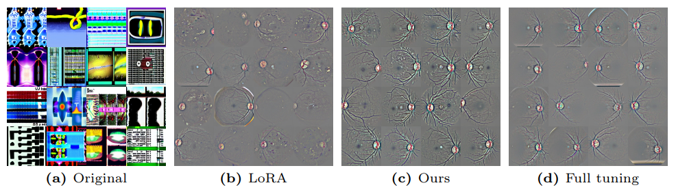 Fig. 20: Images sampled from Stable Diffusion checkpoints fine-tuned on the Diabetic Retinopathy.