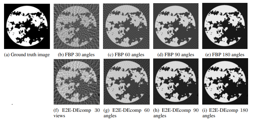 Figure 2: Qualitative comparison between the material decomposition for adipose using E2E-DEcomp and FBP using different number of angular projections.