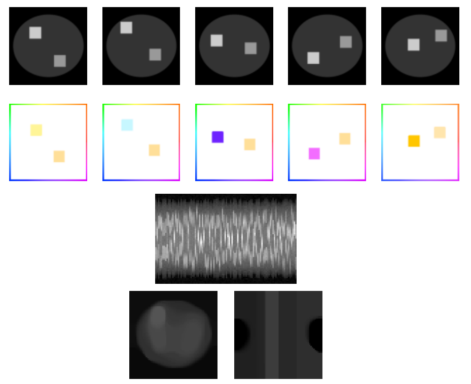Figure 1: First row: ground truth image at frames 15, 35, 55, 75, 95 (out of 100). Second row: velocity field at frames 15, 35, 55, 75, 95 (out of 100). Third row: fan-beam measurements with one random angle projection per time instant. Fourth row left: reconstruction neglecting the time component. Fourth row right: frame-by-frame reconstruction from angle at t = 0.