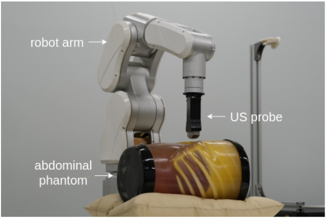 Fig. 1: Our robot-assisted ultrasound imaging system