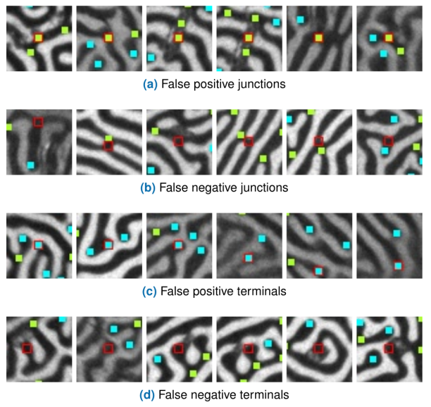 FIGURE 5. Examples of TM-CNN detection errors, highlighted in red. Green and cyan dots are respectively junctions and terminals detected by TM-CNN.