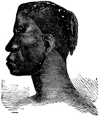 FIG. 6.--Profile of a Luchatze negro woman,showing deficient bridge of nose and chin, and elongate facial region
and prognathism.