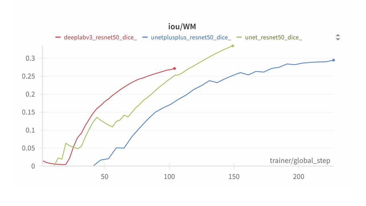 White matter segmentation metrics by network architecture