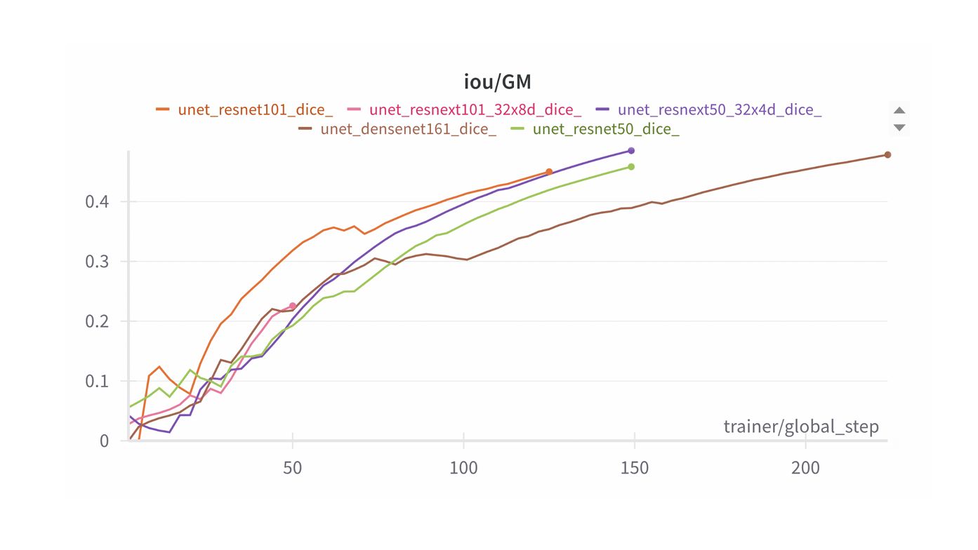Gray matter segmentation metrics by backbone