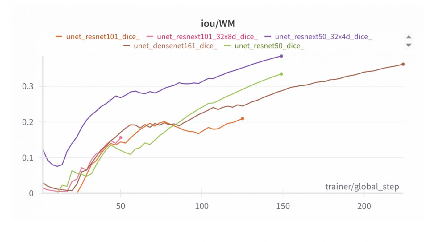 White matter segmentation metrics by backbone