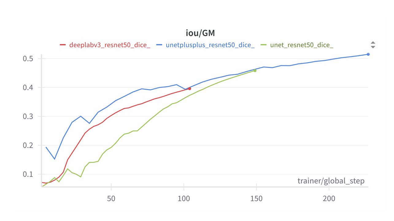 Gray matter segmentation metrics by network architecture