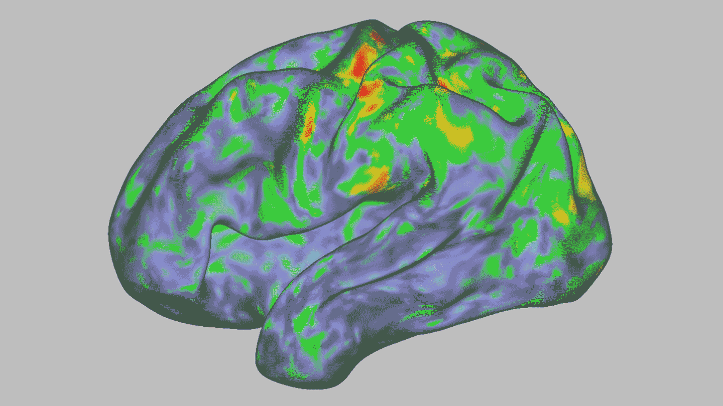 FMRI of the Human Brain