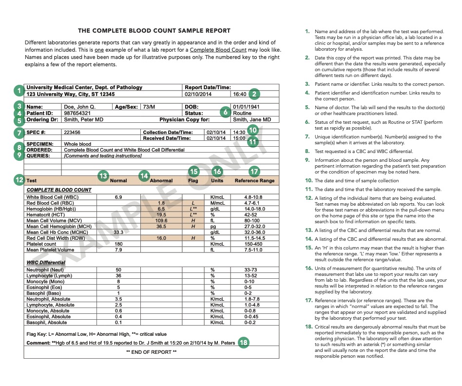 Example of CBC report