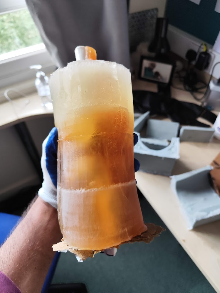 Figure 8. Artificial human knee joint.