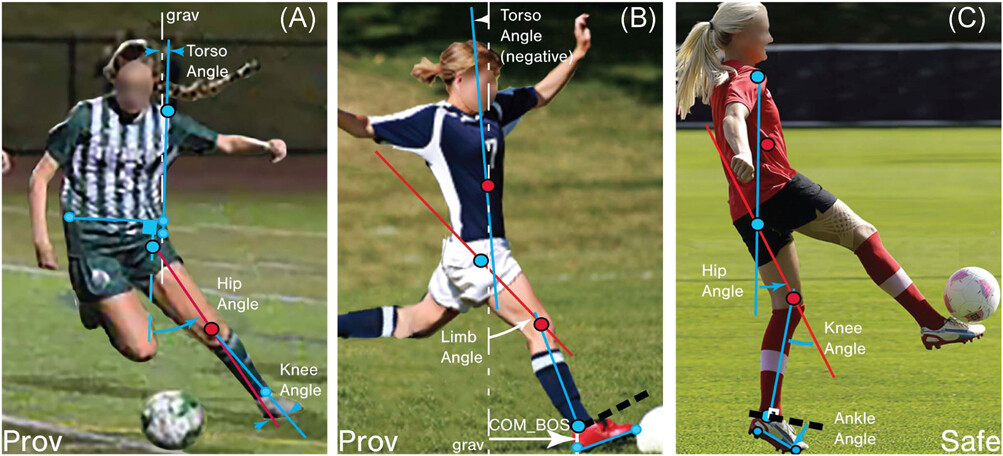 Figure 1. (A, B) show provocative positions resulting in an injury and (C) showsa safe position resulting in non-injury [2].