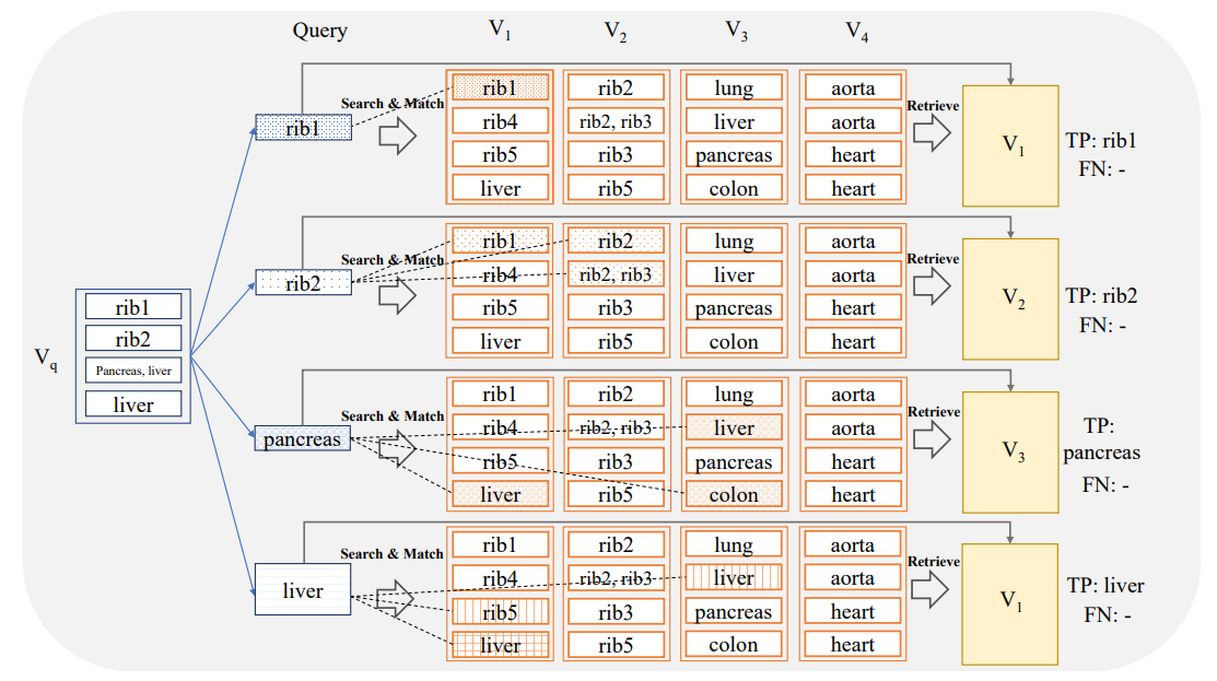 Figure 3: Region-based retrieval. Anatomical regions are considered individually. A sub-volume constrained to an anatomical region of interest r is generated and fed to the search system to retrieve a volume containing the anatomical region. A case is considered a True Positive (TP) if the retrieved case contains the region r at some location.
