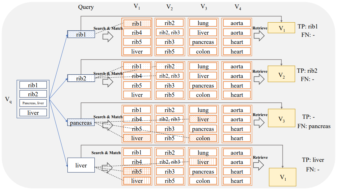 Figure 4: Localized retrieval. Anatomical regions are considered individually. A sub-volume constrained to the anatomical region of interest r is generated and fed to the search system to retrieve a volume containing the same anatomical region. A case is only considered as True Positive (TP) if at least one of the slices in the retrieved volume contains the region r.
