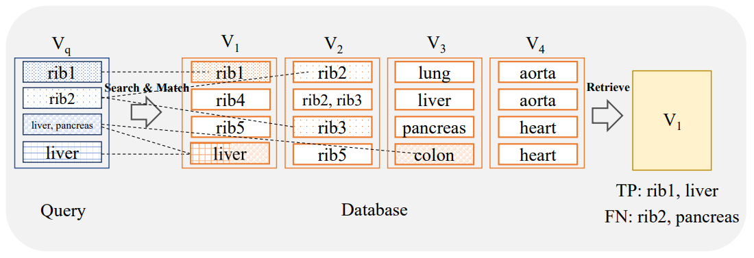 Figure 2: Volume-based retrieval: For a query volume Vq covering a range of anatomical regions, a volume is retrieved that should cover the same anatomical regions. The similarity search is based on all slices from the query volume.